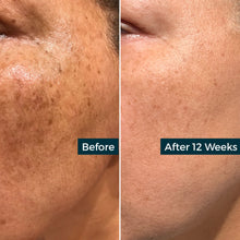 Load image into Gallery viewer, Retinol Plus Vitamin C Skin Refining Night Oil